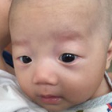 小腰果