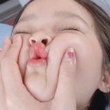 吱吱