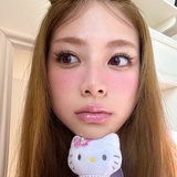 幸运女孩综合症